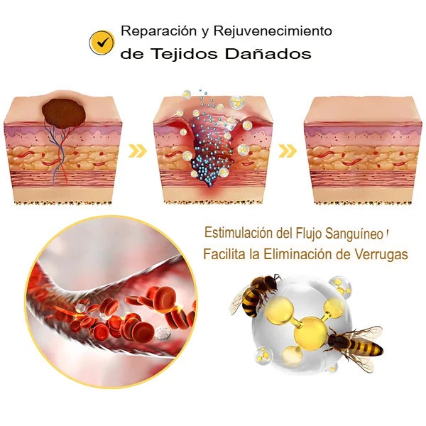 Super Oferta 2x1 BeeClear Spray ¿Lista para decir adiós a las imperfecciones?