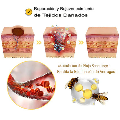 Super Oferta 2x1 BeeClear Spray ¿Lista para decir adiós a las imperfecciones?